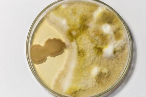 Petri dish with microbial spores