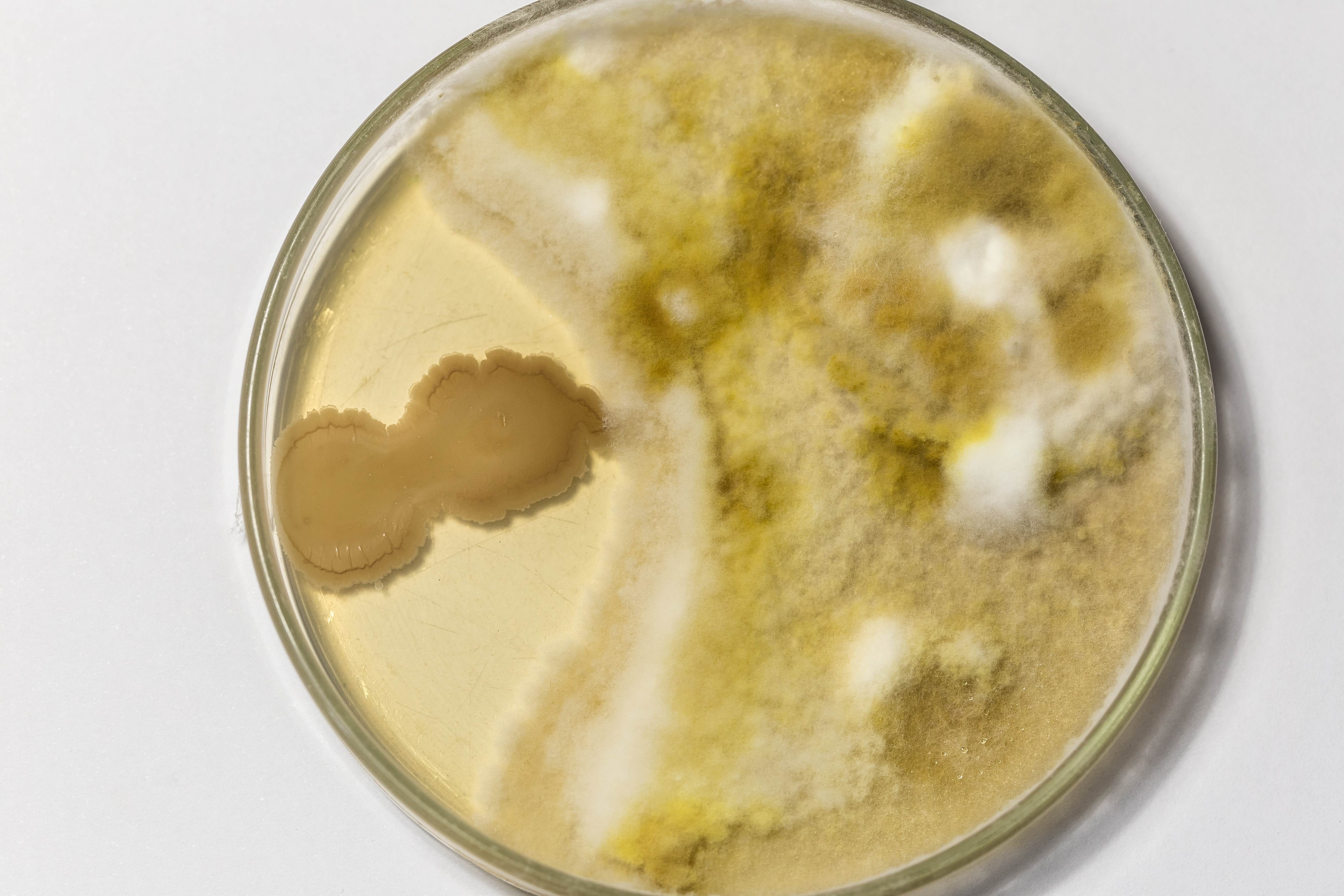 Petri dish with microbial spores