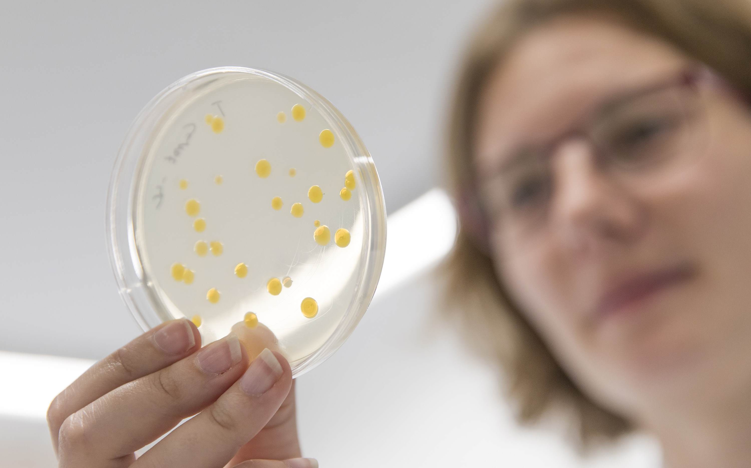 Researcher counts the number of bacterial colonies