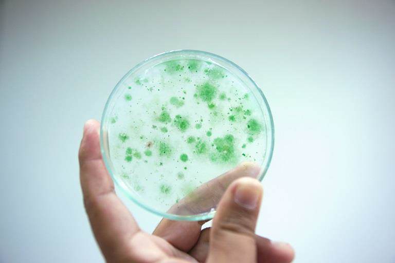 Colony of blue green algae in culture medium plate