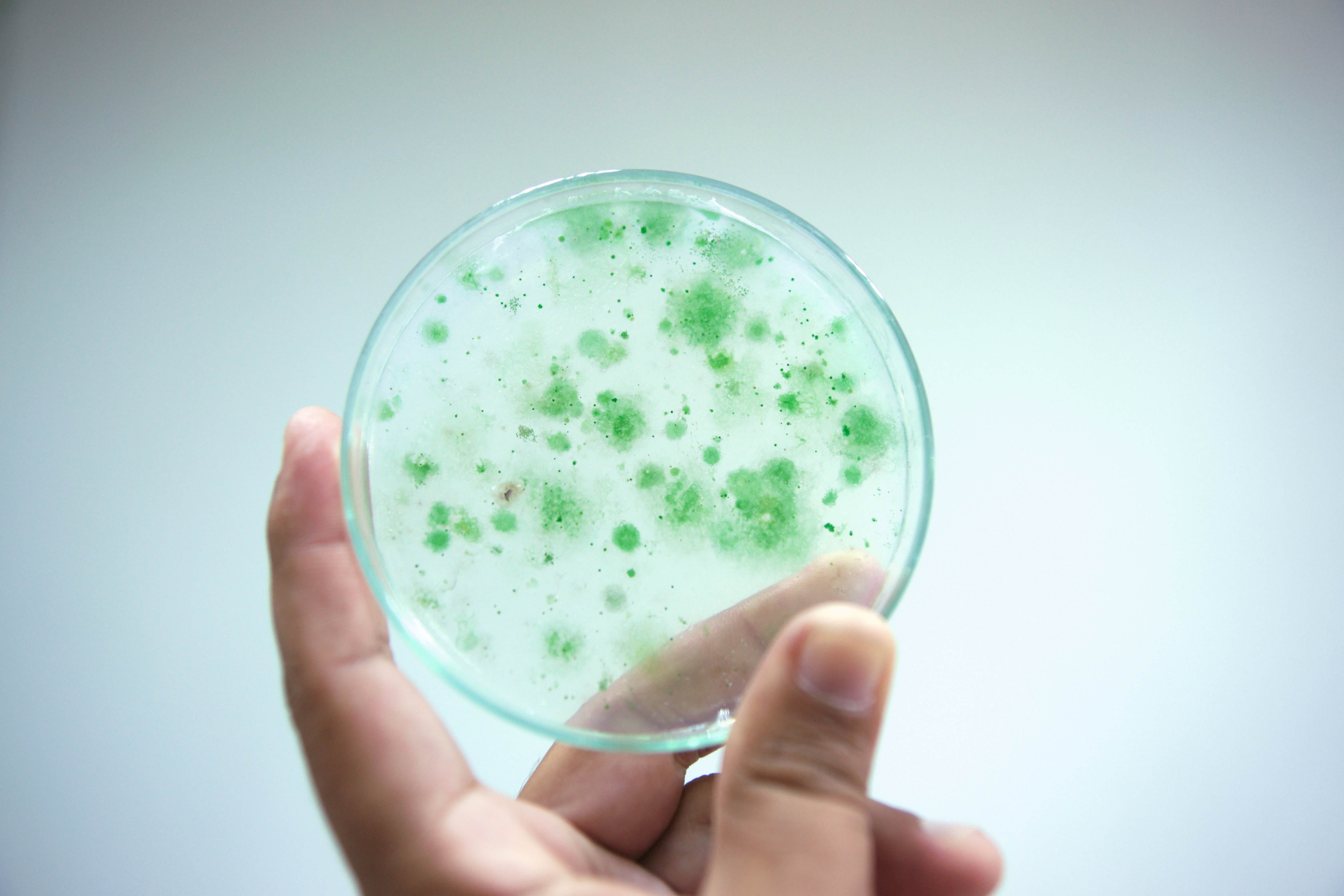 Colony of blue green algae in culture medium plate