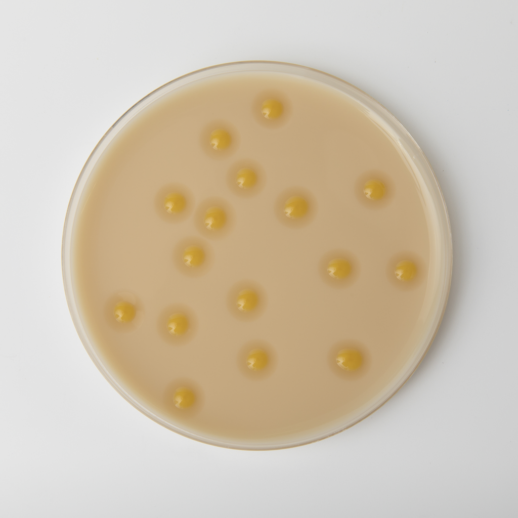 Screening a petri dish