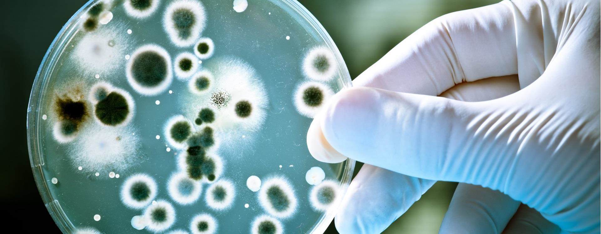 Gloved hand holding a petri dish with spores